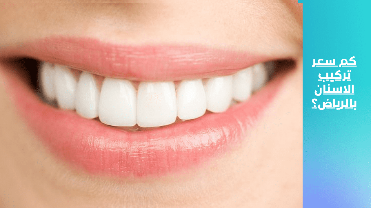 كم سعر تركيب الاسنان بالرياض ؟ من منصة تدريبكم